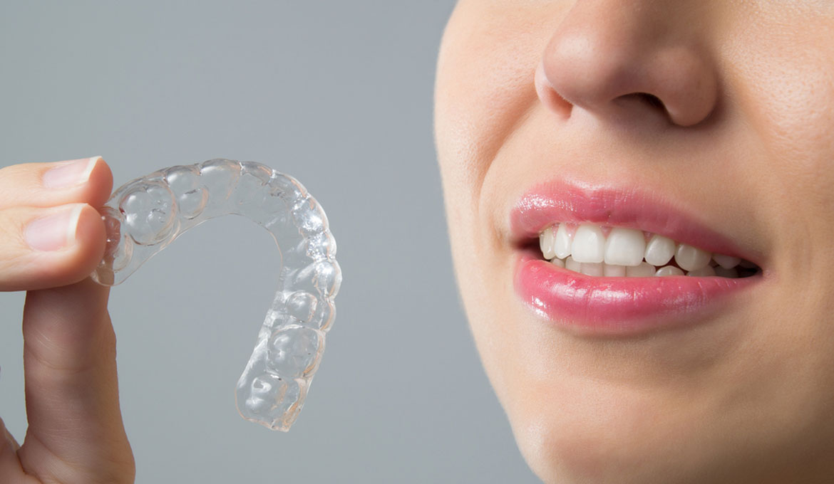 Woman putting in her Invisalign braces. 